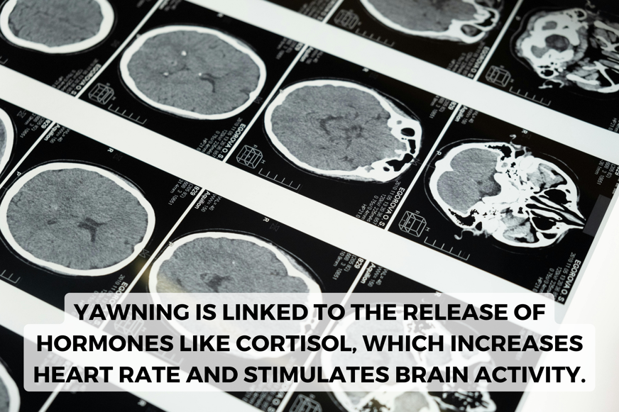 yawning is linked to the release of hormones like cortisol